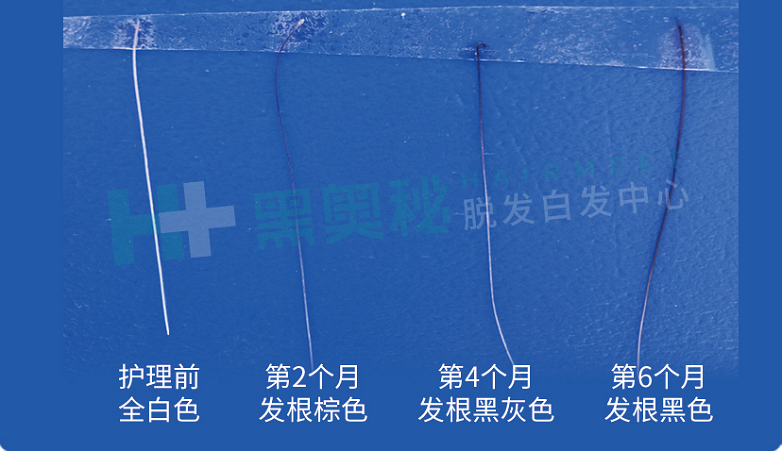 奥秘让5亿脱发白发人也能用的起了！麻将胡了app60万克的富勒烯黑(图6)
